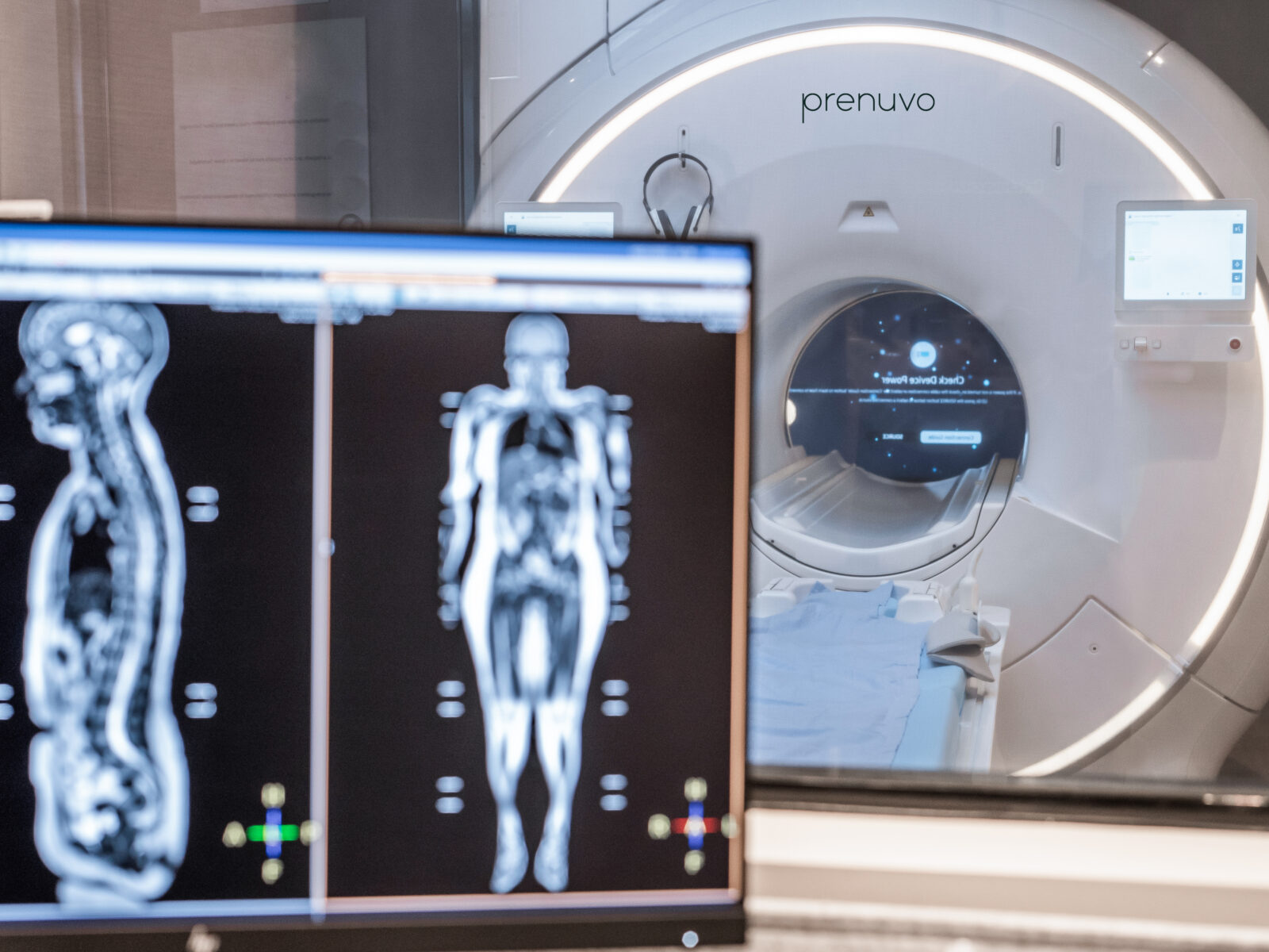 Full Body MRI Scan Chicago IL - Whole Body MRI with Prenuvo