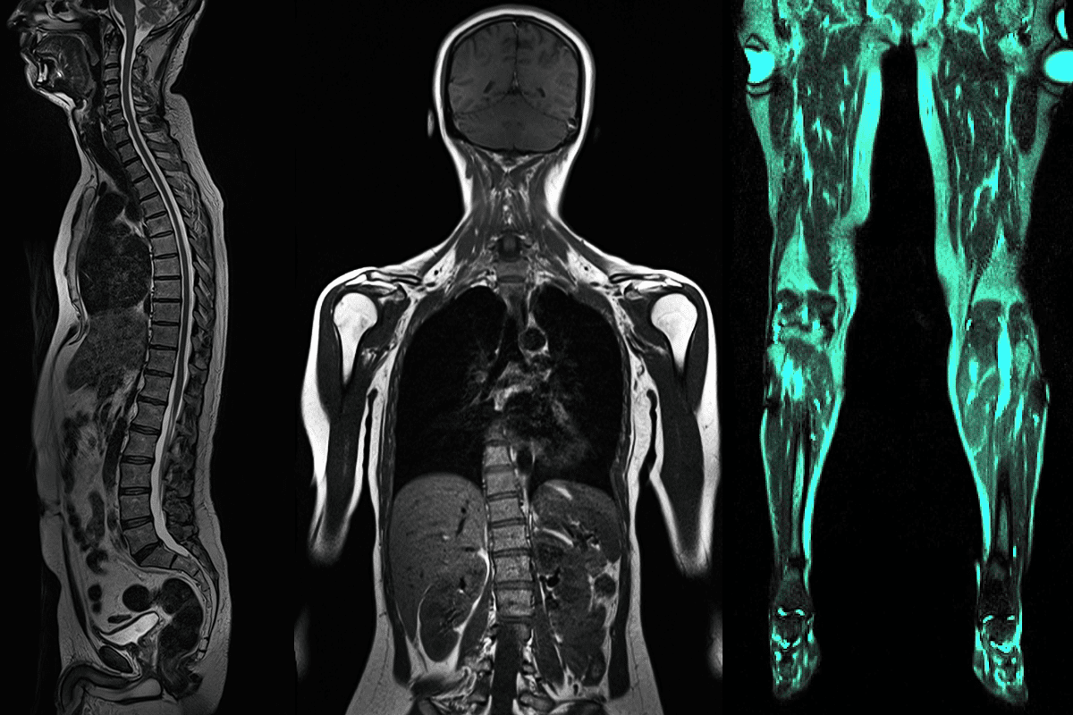 Full Body MRI Scan Chicago IL Biology Diagrams